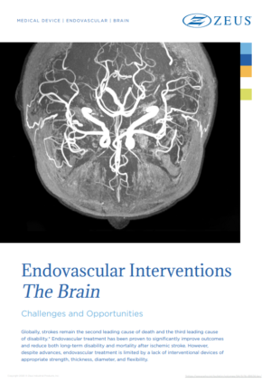 Endovascular Interventions The Brain